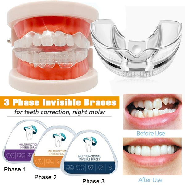 3 Phase Silicone Invisible Tooth Set Orthodontic Braces Teeth Corrector ...