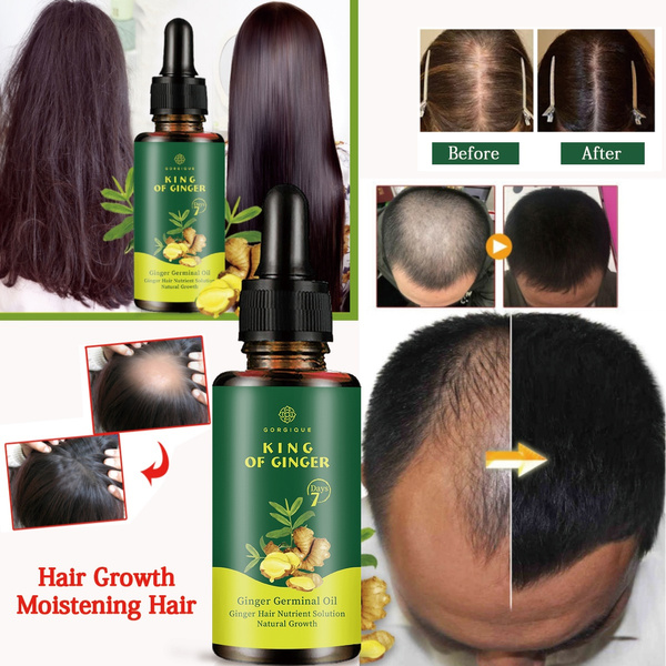 10ml 20ml 30ml 50ml Hair Growth Essence Natural Beauty Hair Growth 10ml 20ml 30ml 50ml Hair Growth Essence Natural Beauty Hair Growth