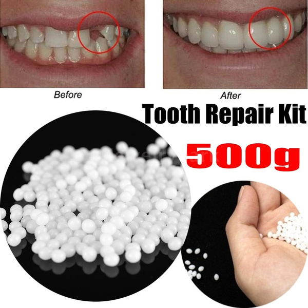 Temporary Tooth Repair Kit Thermal Molding Teeth Repair