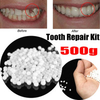 Temporary Tooth Repair Thermal Adhesive Fitting Beads Fake Teeth Veneers