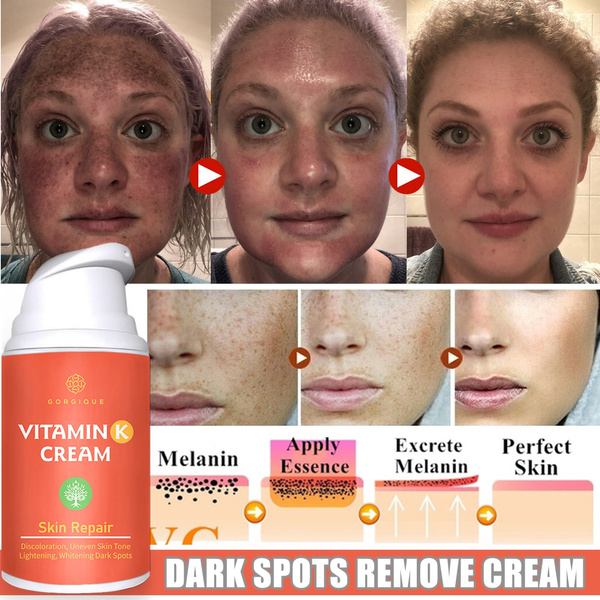melanin cream for face