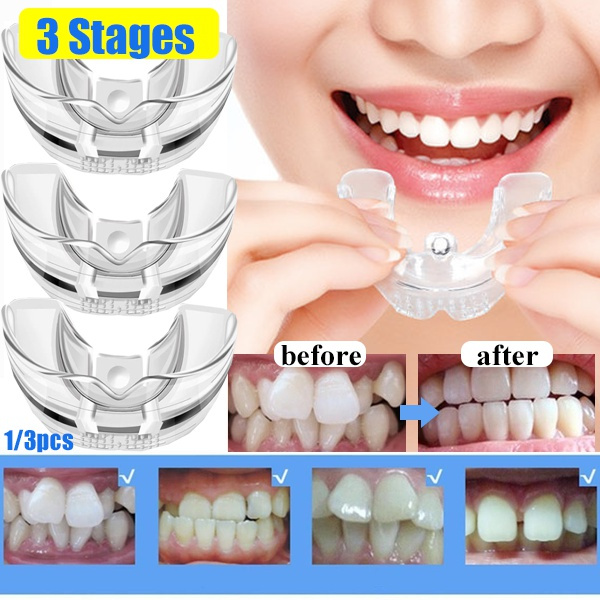 3pcs 1pc Silicone Invisible Teeth Brace Set Dental Orthodontic Braces Teeth Tray 3 Stage Correct Retainer Teeth Corrector Braces Teeth Retainer Bruxism Mouth Guard Mouthguard Braces Wish