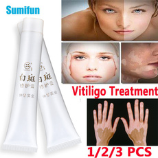 Chinese, ointment, healthampbeauty, vitiligo