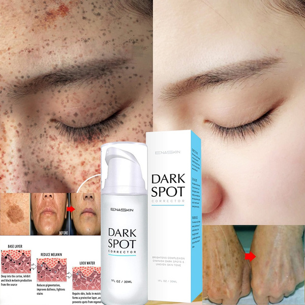 Dark deals spot corrector