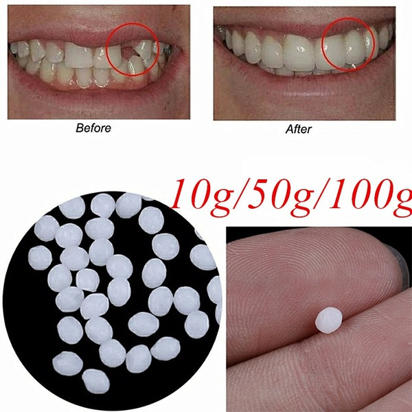 50G Temporary Tooth Solid Glue Teeth Gaps Glue Fix Broken Teeth Adhesive  Beads Denture Fake Teeth