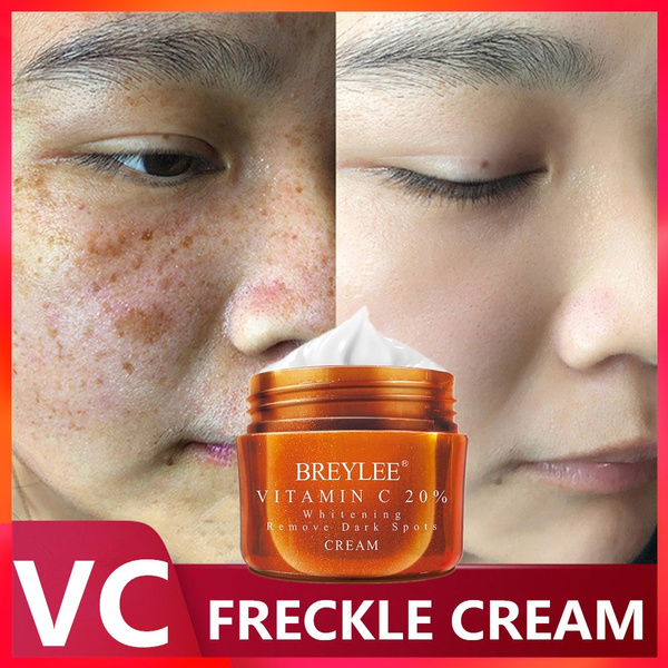vc 20 cream