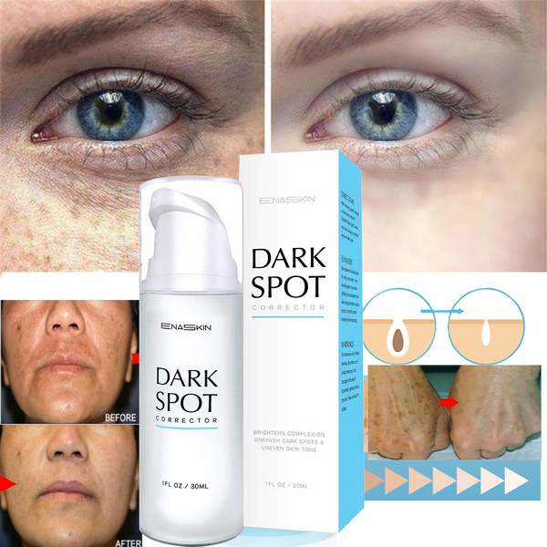 advanced dark spot corrector