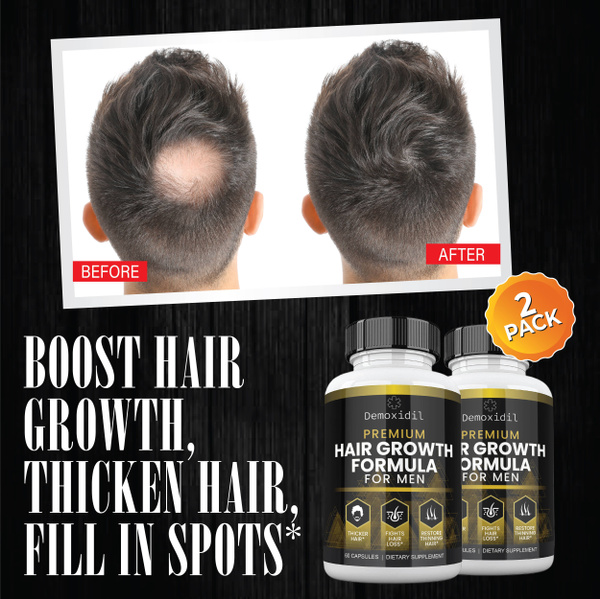 Hair Growth Supplement for Men and Women - Support and Prevent Hair Loss & Thinning - Hair Vitamins with Biotin & Keratin for Thicker Hair - 60 Tablets | Wish Hair Growth Supplement for Men and Women - Support and Prevent Hair Loss & Thinning - Hair Vitamins with Biotin & Keratin for Thicker Hair - 60 Tablets | Wish