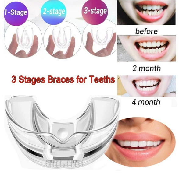 3 Stages Adults Orthodontic Trainer Dental Tooth Appliance Alignment