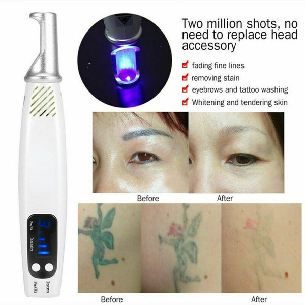 9 Mode plasma pen freckle remove pen wart remover mole tattoo remover  instruments skin tag removal spot cleaner beauty care | Fruugo TR