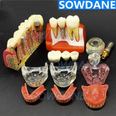 dentalmodel, dentalimplantmodel, toothmodel, maxillarymodel