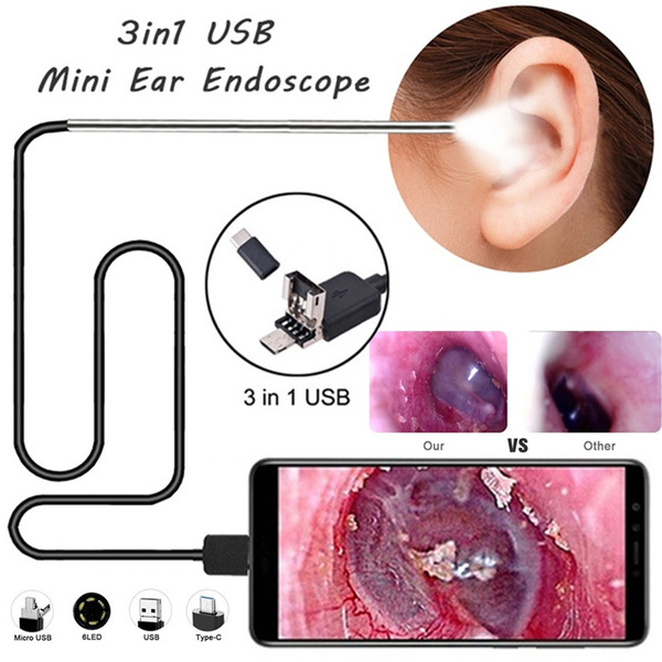 New 3In1 Usb Earpick Mini Camera Endoscope Ear Cleaning Tool Hd