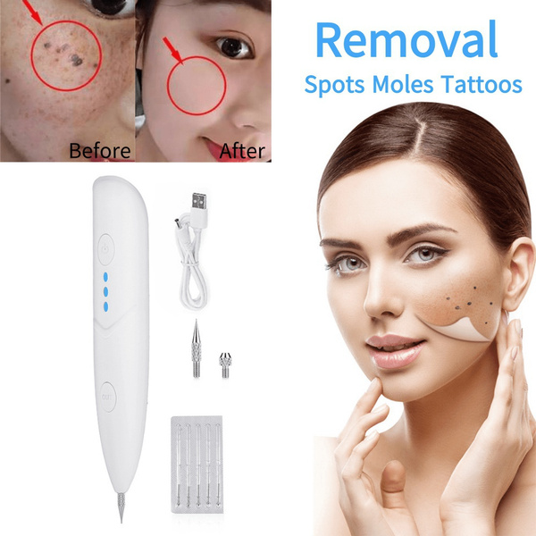 Buy Gdeal Laser Electric Ion Beauty Mole Removal Painless Sweep Pen for Spot  Tattoo Freckle Wart Tag Removal Pen online | eRomman