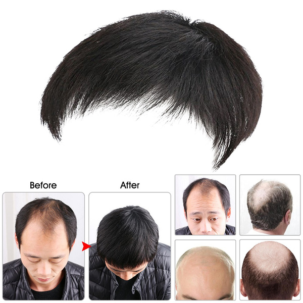 artificial hair for men