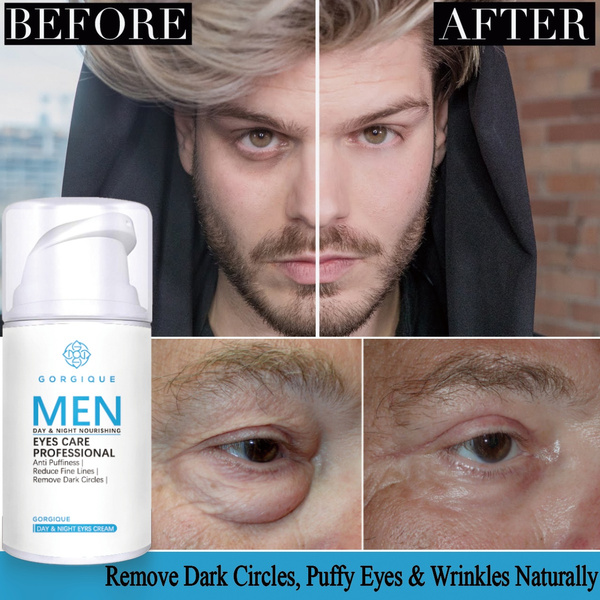 Dark circle eye cream deals for men