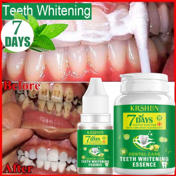 dental bleaching powder