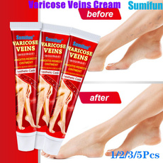 varicoseveinsointment, veinscream, veinstreatment, varicose