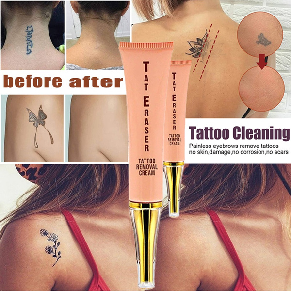 The Pros and Cons of Tattoo Removal  Arts of Attraction
