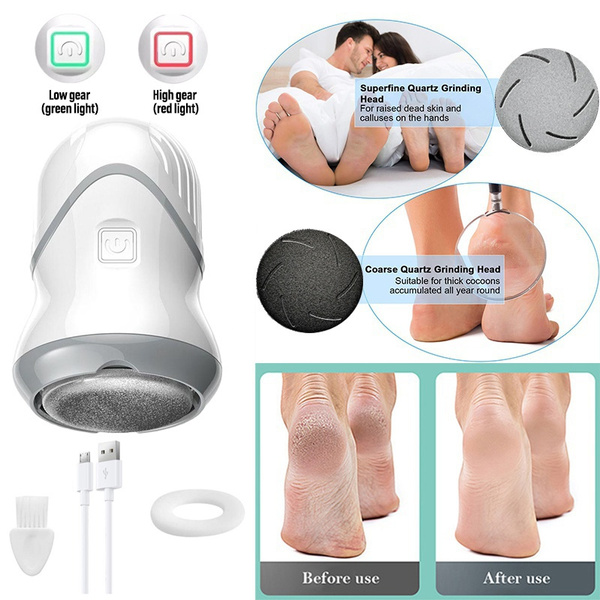 Electric Foot Callus Remover with Vacuum Foot Grinder Rechargeable