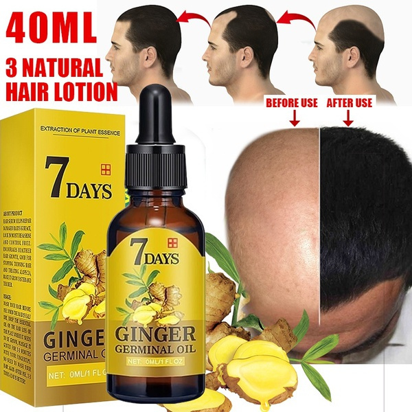 Regrowth Ginger Spray Oriental Oilss Hair Nutrition Hair Loss Treatment  40ml,11 | Regrowth Ginger Spray Oriental Oilss Hair Nutrition Hair Loss  Treatment 40ml,11 