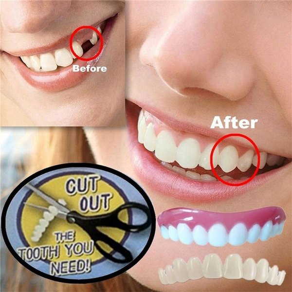 Temporary Dental Sticker Tooth Kit replaces missing teeth in minutes without staining Wish