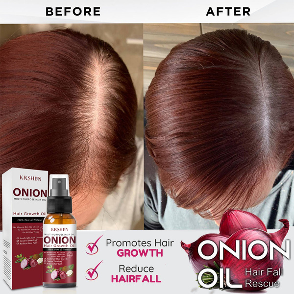 10/20/30/50ml Onion Hair Oil Spray for Hair Growth Anti Hair Loss