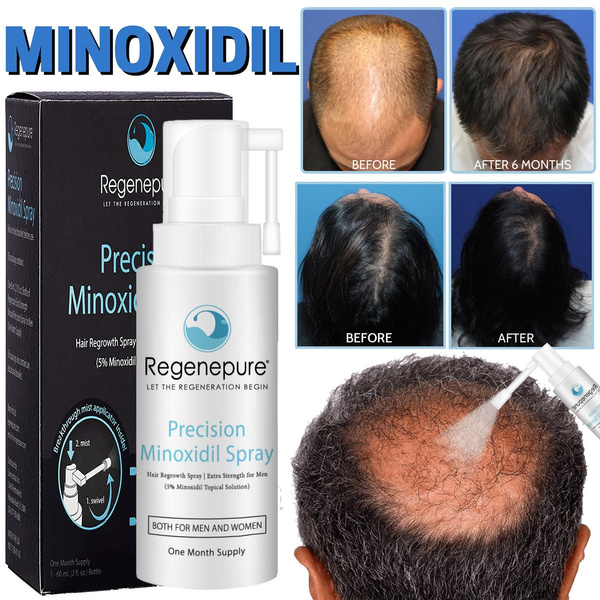 10/20/30/50ml Precision Minoxidil Spray for Men and Women 5% Minoxidil Hair  Growth Treatment | Wish