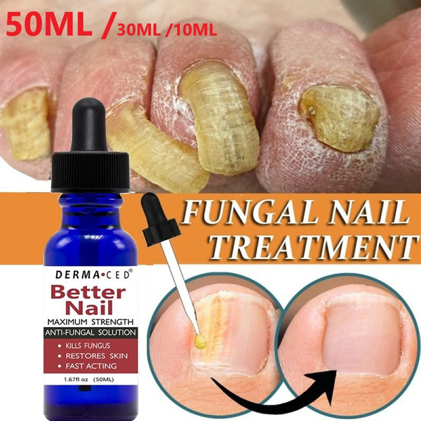 50ml/30ml/10ml Super antifungal treatment The best nail repair