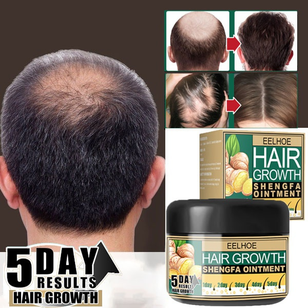 Strong and effective rapid growth!!!30ml Eelhoe Moroccan Germination Cream Hair Repair Cream Natural Hair Loss Treatment For Hair Growth Serum Hair Care Product Hair Serum Fast Hair Growth Hair Growth Hair | Strong and effective rapid growth!!!30ml Eelhoe Moroccan Germination Cream Hair Repair Cream Natural Hair Loss Treatment For Hair Growth Serum Hair Care Product Hair Serum Fast Hair Growth Hair Growth Hair |