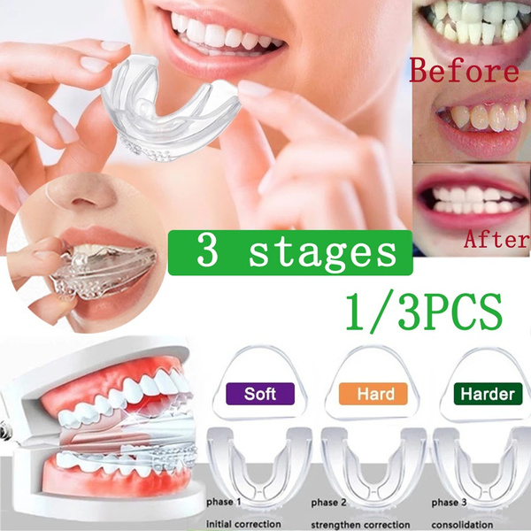 dente, bracesforteeth, orthododontic, Silicone