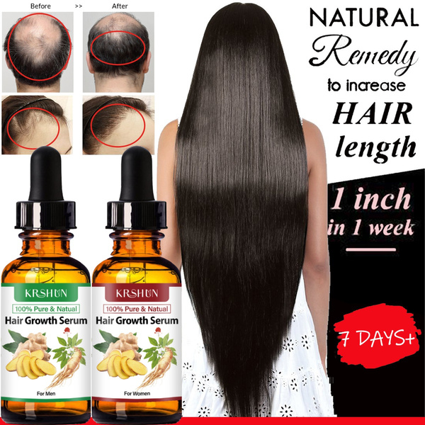 Natural Ginger King 7 Days Hair Growth Essential Oil Hair Regrowth Oil Anti Hair  Loss Liquid for Men and Women 10ML/20ML/30ML/50ML | Wish