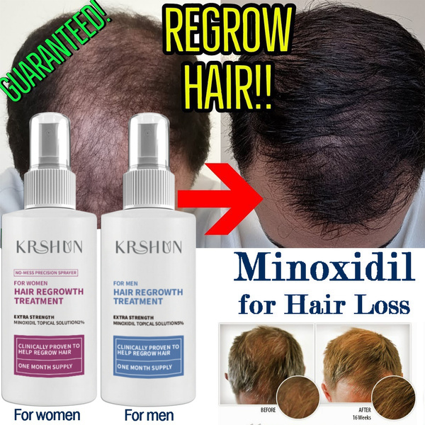 minoxidil 5 hair growth treatment