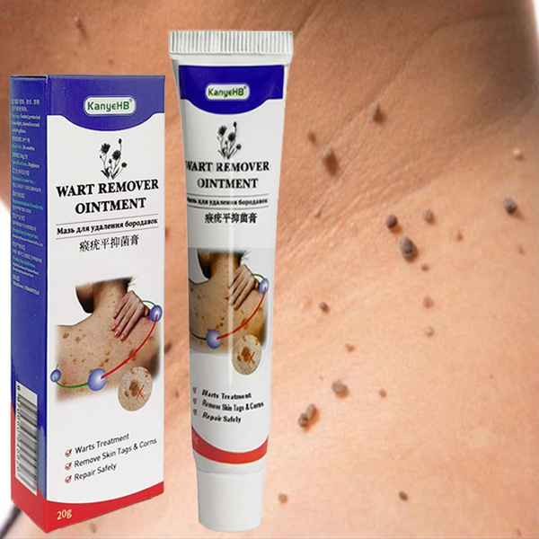 20g Wart Remover Ointment Genital Vulva Condyloma Acuminatum Skin Tag Remover Antibacterial 5734