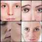 thumbnail - 2