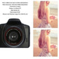 thumbnail - 6