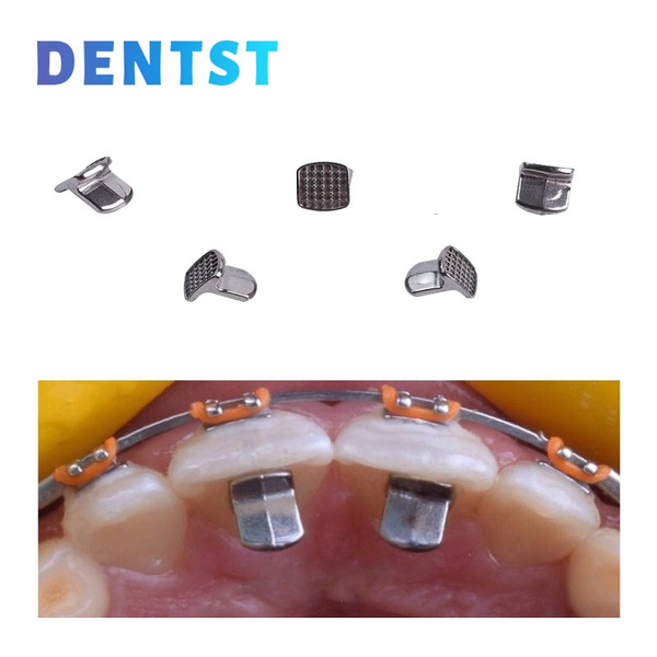 10pcs/bag Dental Orthodontic Bite Opener Bondable Hinge Tongue Tamer