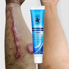 freckle removal, Chinese, burnsrepair, scarcream