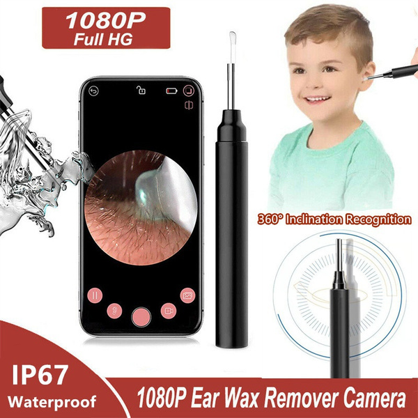 Usb Ear Endoscope With Earwax Removal Tool - Waterproof Ear Camera