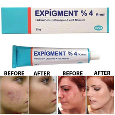 expigment, Skincare, melasma, Whitening