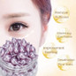 thumbnail - 1