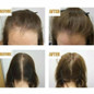 thumbnail - 2