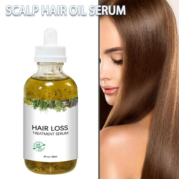 1pc/5pcs 60ml Hair Loss Treatment Serum Rosemary Essential Oil for All ...