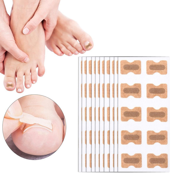 20 25 30 50 60 100pcs Nail Correction Stickers Ingrown Toenail