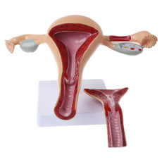 uteru, disease, anatomical, anatomy